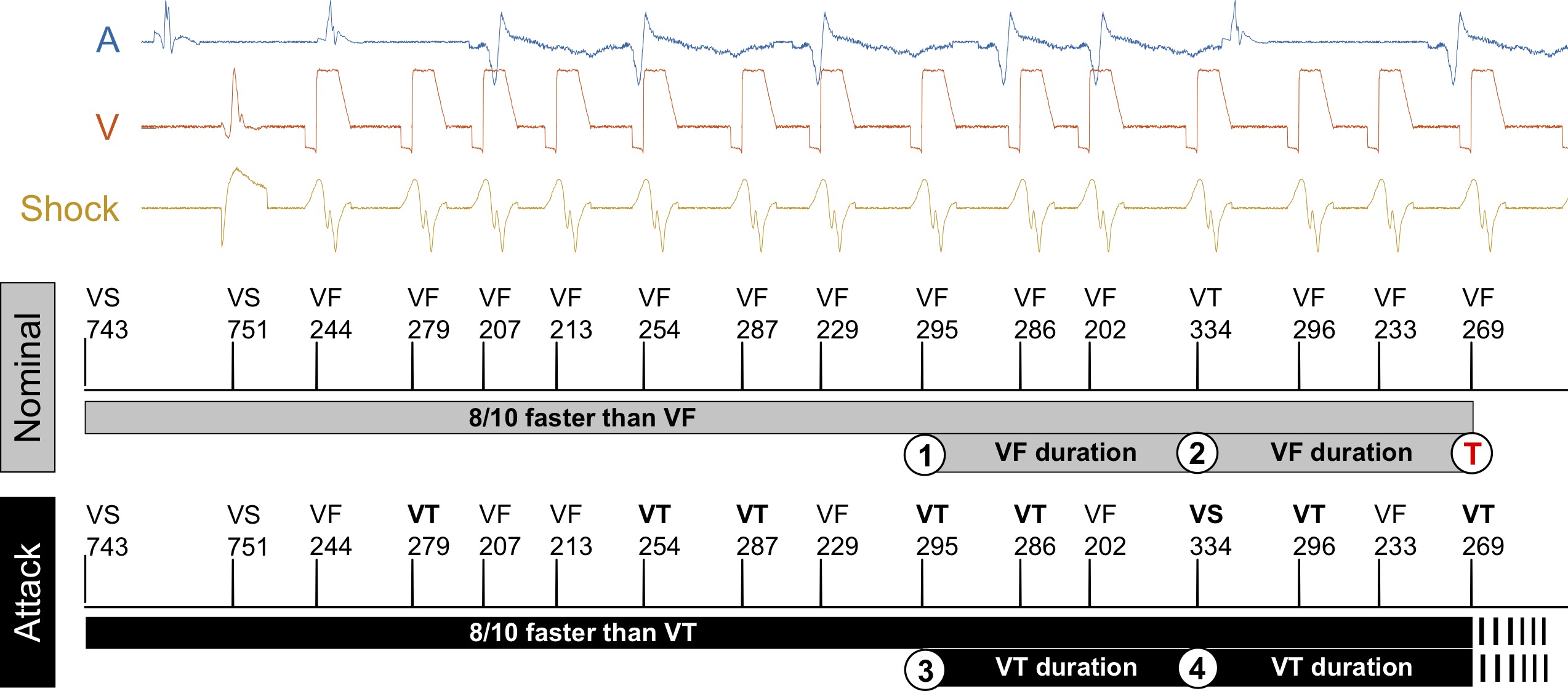 Synthesizing Stealthy Attacks on Cardiac Devices